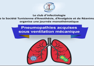 Pneumopathie acquise sous Ventilation Mécanique
